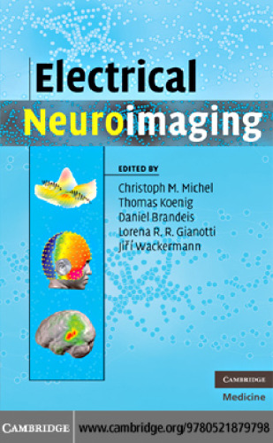 Electrical Neuroimaging