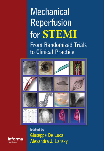 Mechanical Reperfusion for STEMI: From Randomized Trials to Clinical Practice