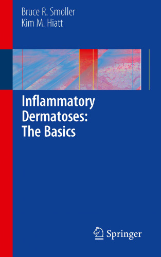 Inflammatory Dermatoses: The Basics