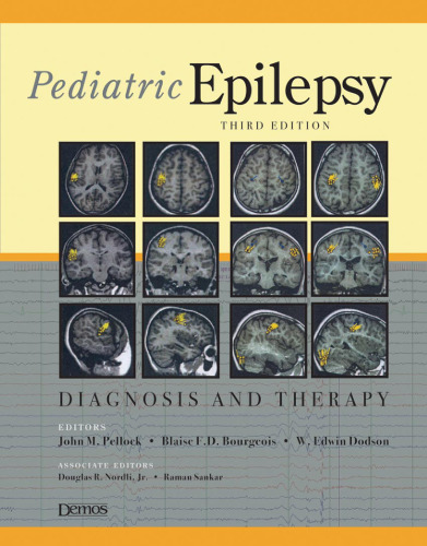 Pediatric Epilepsy: Diagnosis and Therapy 3rd Edition