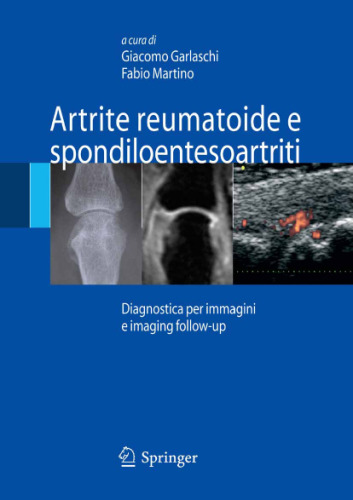 Artrite reumatoide e spondiloentesoartriti: Diagnostica per immagini ed imaging follow-up