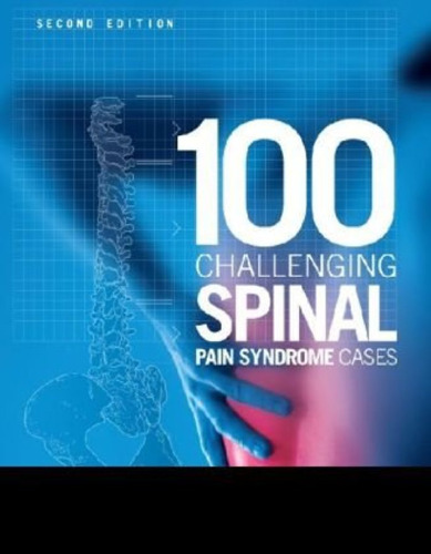 100 Challenging Spinal Pain Syndrome Cases 2nd Edition