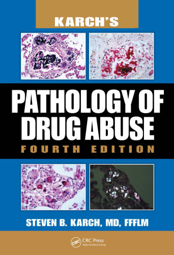 Karch's Pathology of Drug Abuse, Fourth Edition