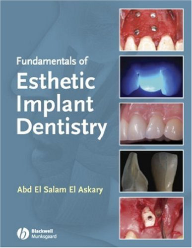 Fundamentals of Esthetic Implant Dentistry, Second Edition