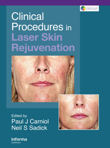 Clinical Procedures in Laser Skin Rejuvenation (Series in Cosmetic and Laser Therapy)
