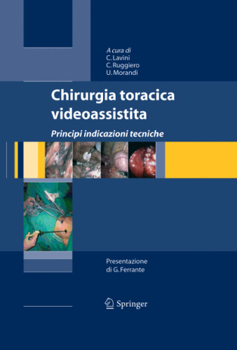 Chirurgia toracica videoassistita