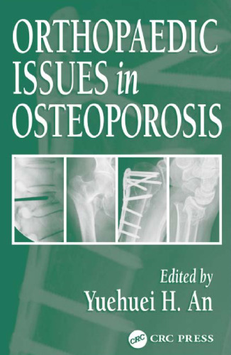Orthopaedic Issues in Osteoporosis