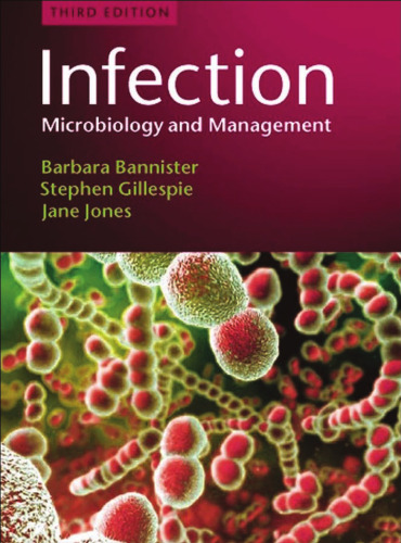 Infection: Microbiology and Management