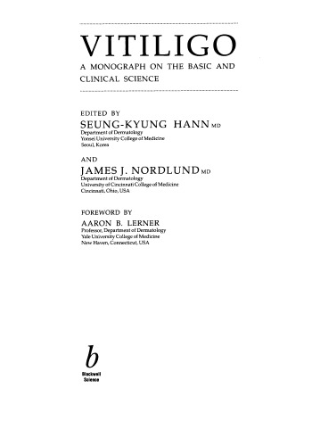 Vitiligo: A Monograph on the Basic and Clinical Science