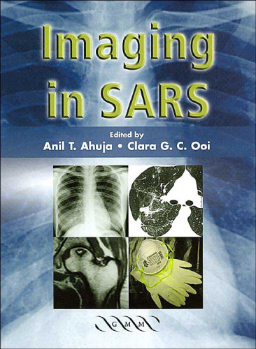 Imaging in SARS