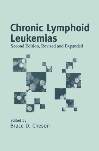 Chronic Lymphoid Leukemias, Second Edition, (Basic and Clinical Oncology)
