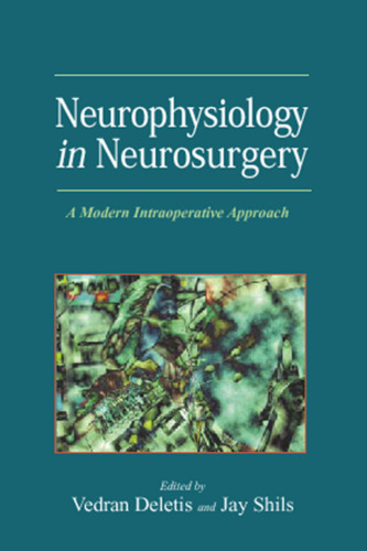 Neurophysiology in Neurosurgery: A Modern Intraoperative Approach