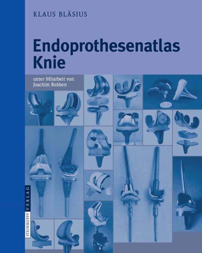 Endoprothesenatlas Knie (German Edition)