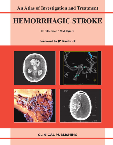 Hemorrhagic Stroke: An Atlas of Investigation and Treatment (Atlas of Assessment, Diagnosis and Management)