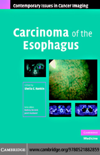 Carcinoma of the Esophagus (Contemporary Issues in Cancer Imaging)