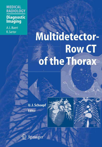 Multidetector-Row CT of the Thorax (Medical Radiology   Diagnostic Imaging)