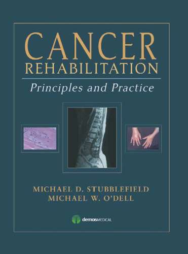 Cancer Rehabilitation: Principles and Practice