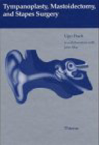 Tympanoplasty, Mastoidectomy and Stapes Surgery