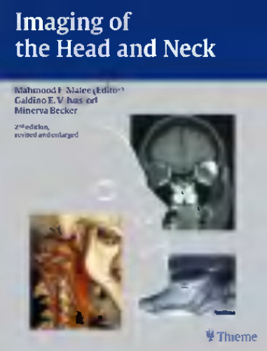 Imaging of the Head and Neck 2nd Edition