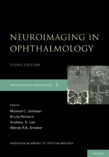 Neuroimaging in Ophthalmology (Opthamology Monograph Series)