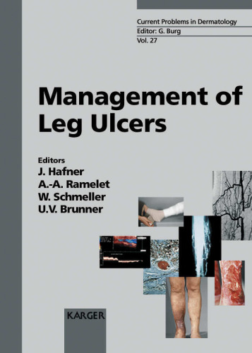 Management of Leg Ulcers (Current Problems in Dermatology Vol 27)
