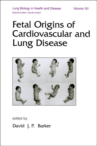 Lung Biology in Health & Disease Volume 151 Fetal Origins of Cardiovascular and Lung Disease