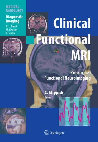 Clinical Functional MRI: Presurgical Functional Neuroimaging (Medical Radiology   Diagnostic Imaging)