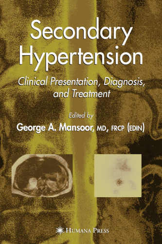 Secondary Hypertension: Clinical Presentation, Diagnosis, and Treatment (Clinical Hypertension and Vascular Diseases)