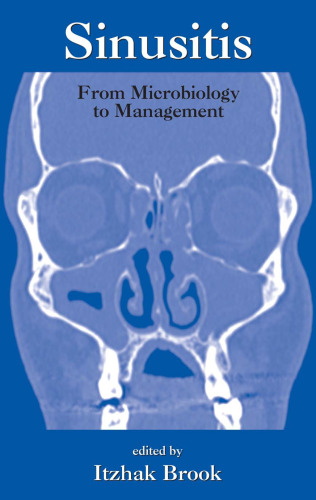 Sinusitis. From microbiology to management