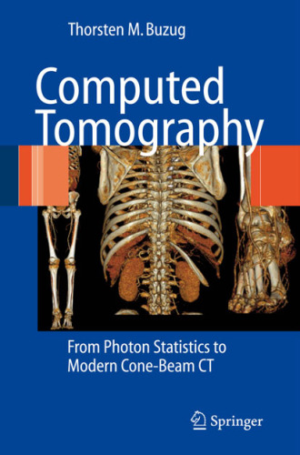 Computed tomography: From photon statistics to modern cone-beam CT