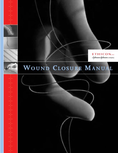 Wound Closure Manual