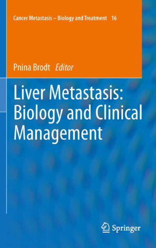 Liver Metastasis: Biology and Clinical Management