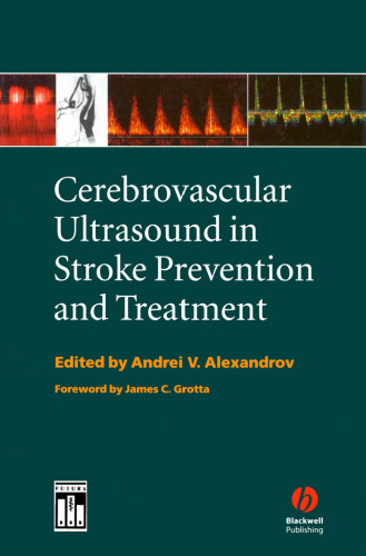 Cerebrovascular Ultrasound in Stroke Prevention and Treatment
