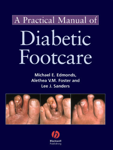 A Practical Manual of Diabetic Foot Care