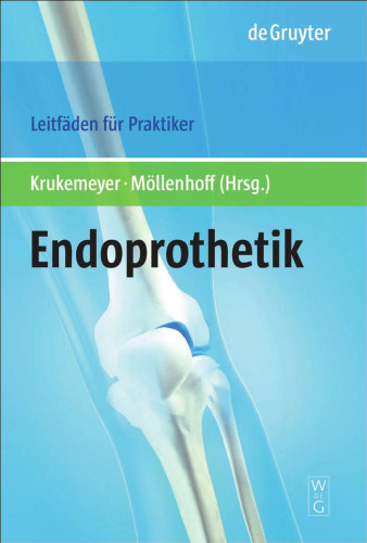 Endoprothetik: Leitfäden für Praktiker