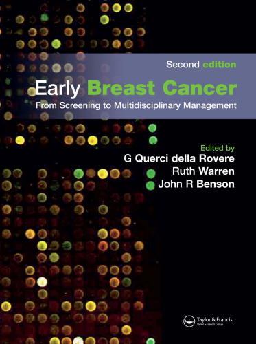 Early Breast Cancer: From Screening to Multidisciplinary Management 2nd Edition