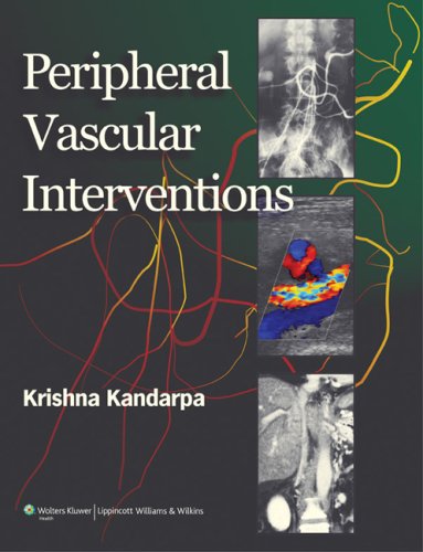 Peripheral Vascular Interventions