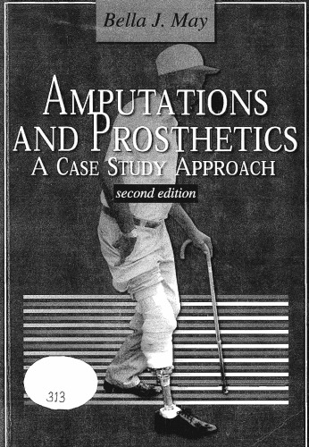 Amputations and Prosthetics: A Case Study Approach