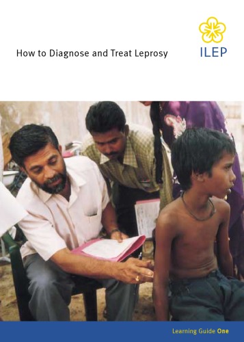 How to Diagnose & Treat Leprosy