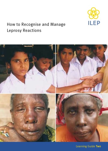 How to Recognise and Manage Leprosy Reactions (ILEP learning guides on leprosy)