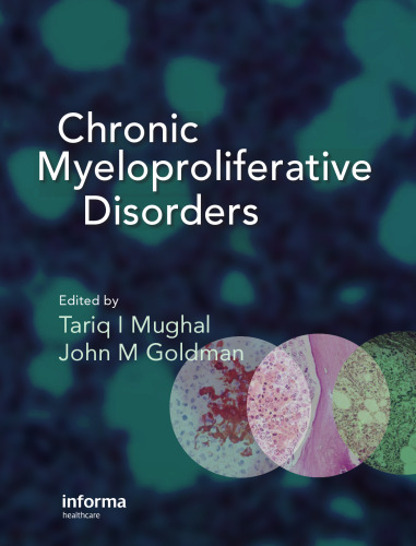 Chronic Myeloproliferative Disorders