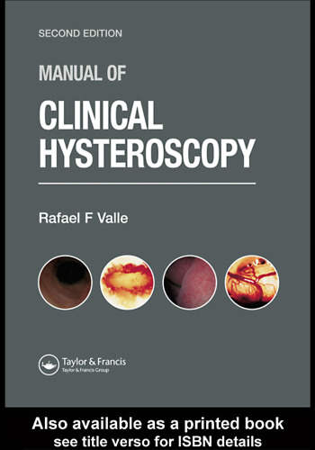Manual of Clinical Hysteroscopy, Second Edition
