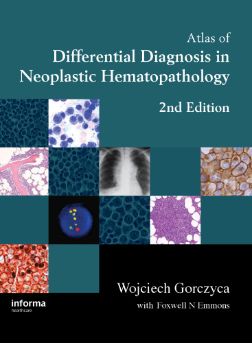 An Atlas of Differential Diagnosis in Neoplastic Hematopathology