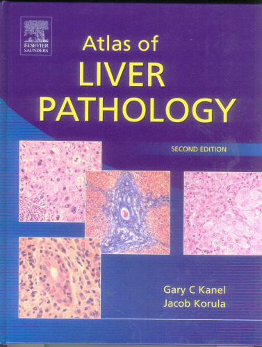Atlas of Liver Pathology, Second Edition (ATLAS OF SURGICAL PATHOLOGY)