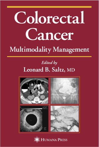 Colorectal Cancer: Multimodality Management (Current Clinical Oncology)