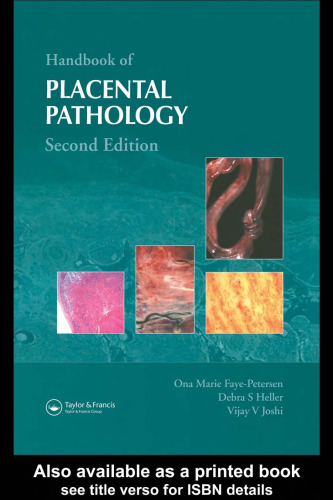 Handbook of Placental Pathology, Second Edition