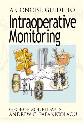 A Concise Guide to Intraoperative Monitoring
