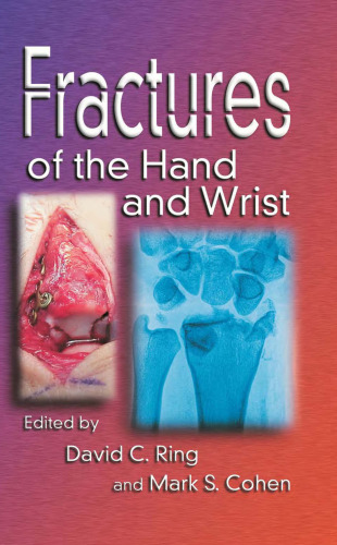 Fractures of the Hand and Wrist
