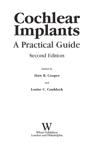 Cochlear Implants: A Practical Guide