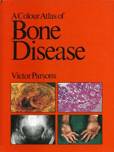 A Colour Atlas of Bone Disease (Wolfe Medical Atlases)